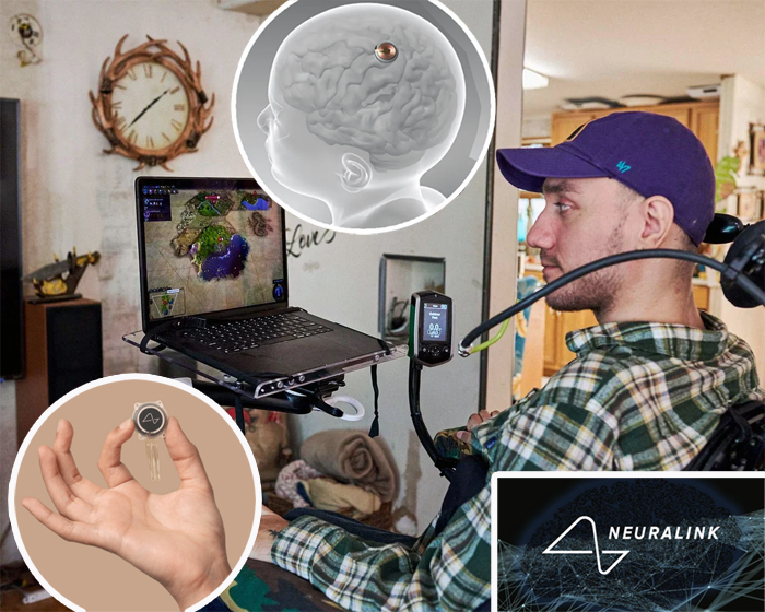 Tetraplegic patient using a brain-computer interface to move a cursor by thought, illustrating mind–machine integration.